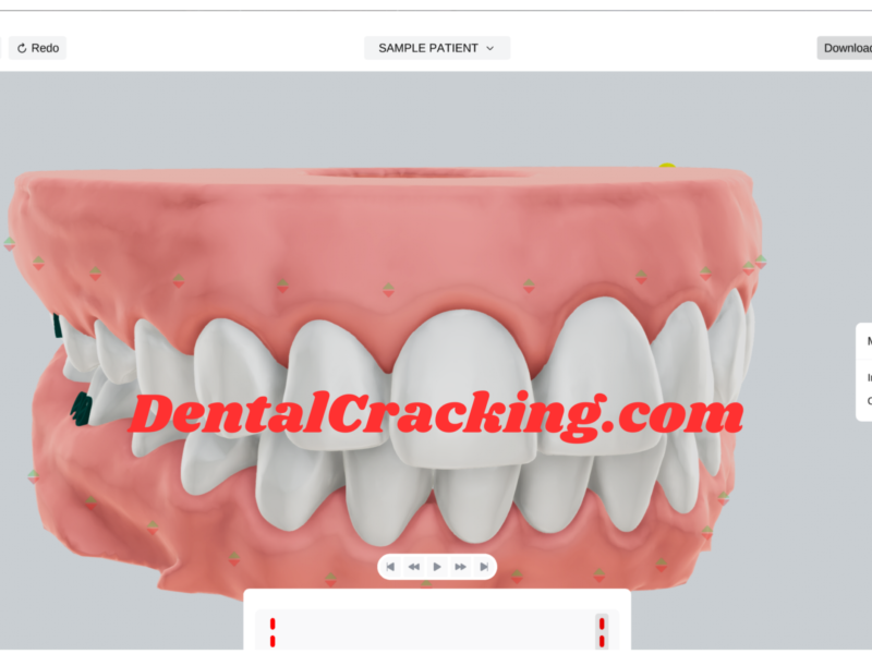 ArchForm 2.2.1 Crack Direct Aligner Print