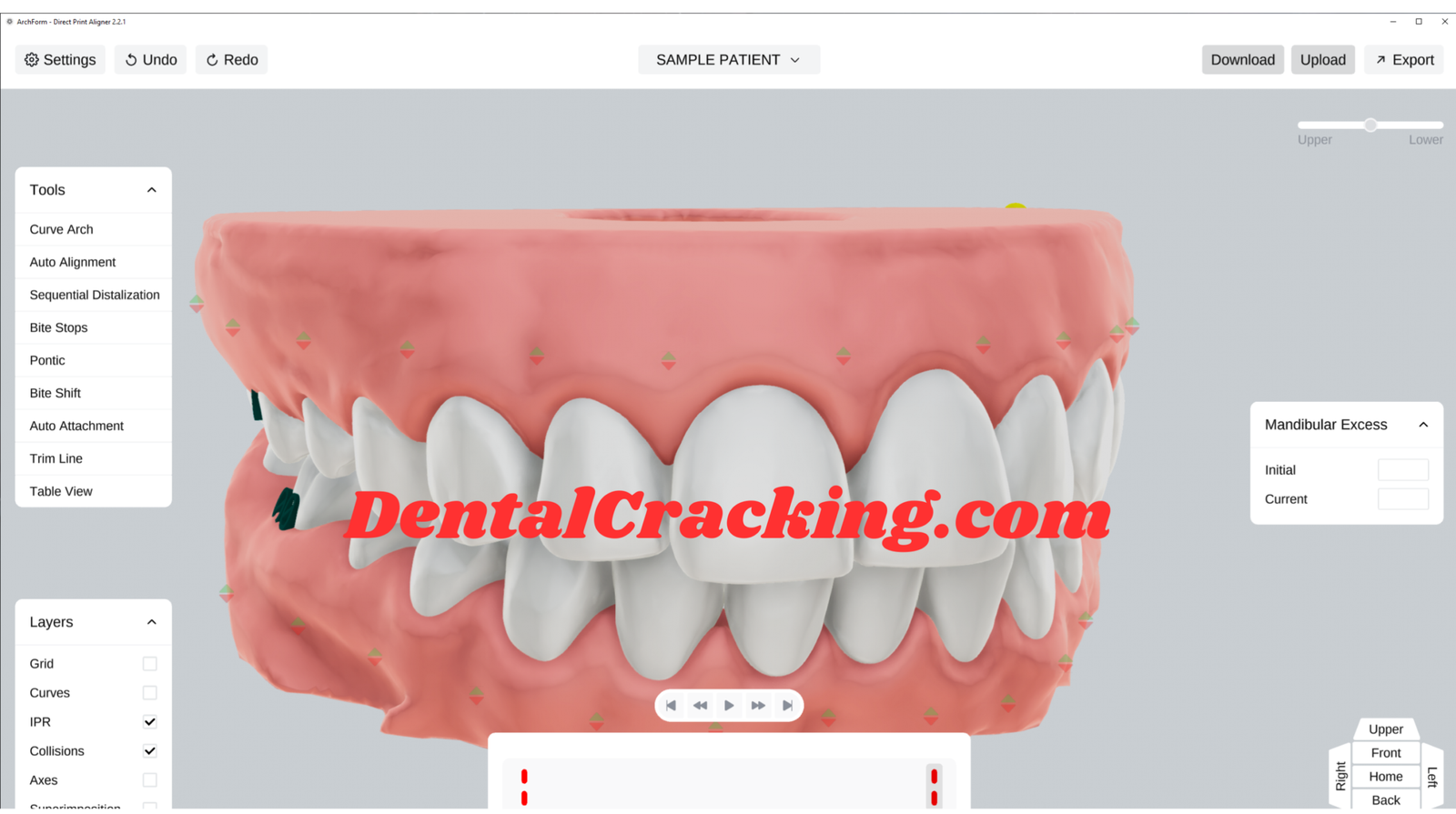ArchForm 2.2.1 Crack Direct Aligner Print