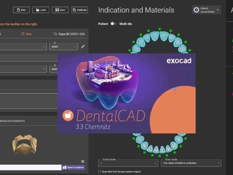 Exocad 3.3 Chemnitz Crack (2025) – Full Version