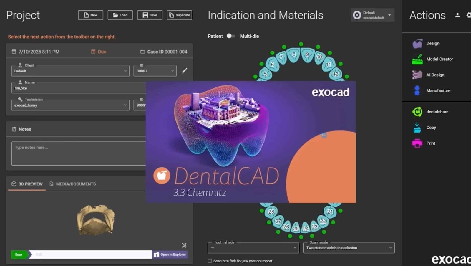 Exocad 3.3 Chemnitz Crack (2025) – Full Version (soon)