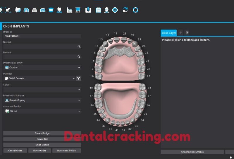 Dental Wings (DOWS) 2024 crack Last version
